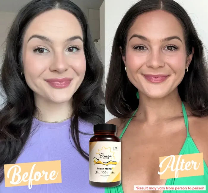 Bronze Bites - 1 Bottle
